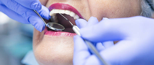 Best Emergency Dental Care for Trauma or Injury in Urbana, IL